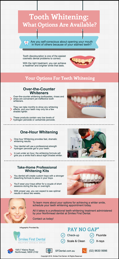 Tooth-Whitening-What-Options-Are-Available