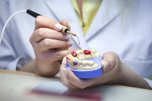 How Long Do Dental Crowns Last Smiles First Dental