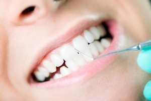 Smiles First Dental | Gum Disease | Dentist Northmead