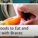Top Foods to Eat and Avoid with Braces from Smiles First Dental