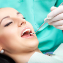 All that You Need to Know About Chipped Tooth Filling